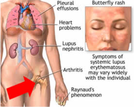 2. What Are The Symptoms?