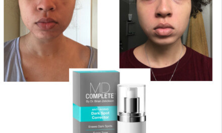 GEM Recommends: MD Complete Dark Spot Corrector